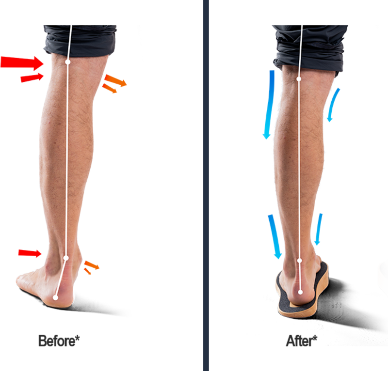 Load image into Gallery viewer, SoleSteps®
