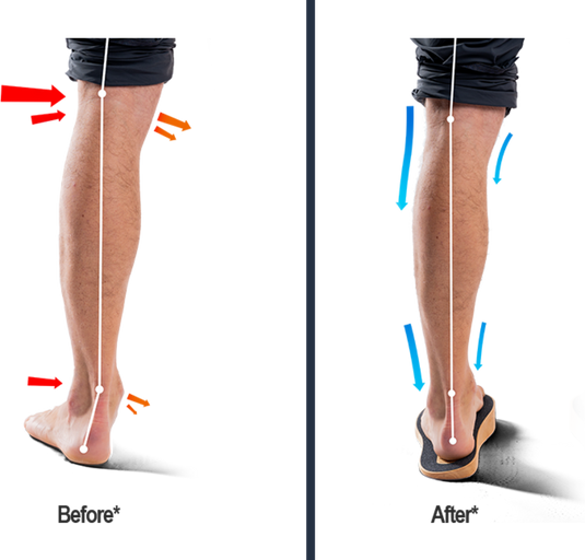 SoleSteps®